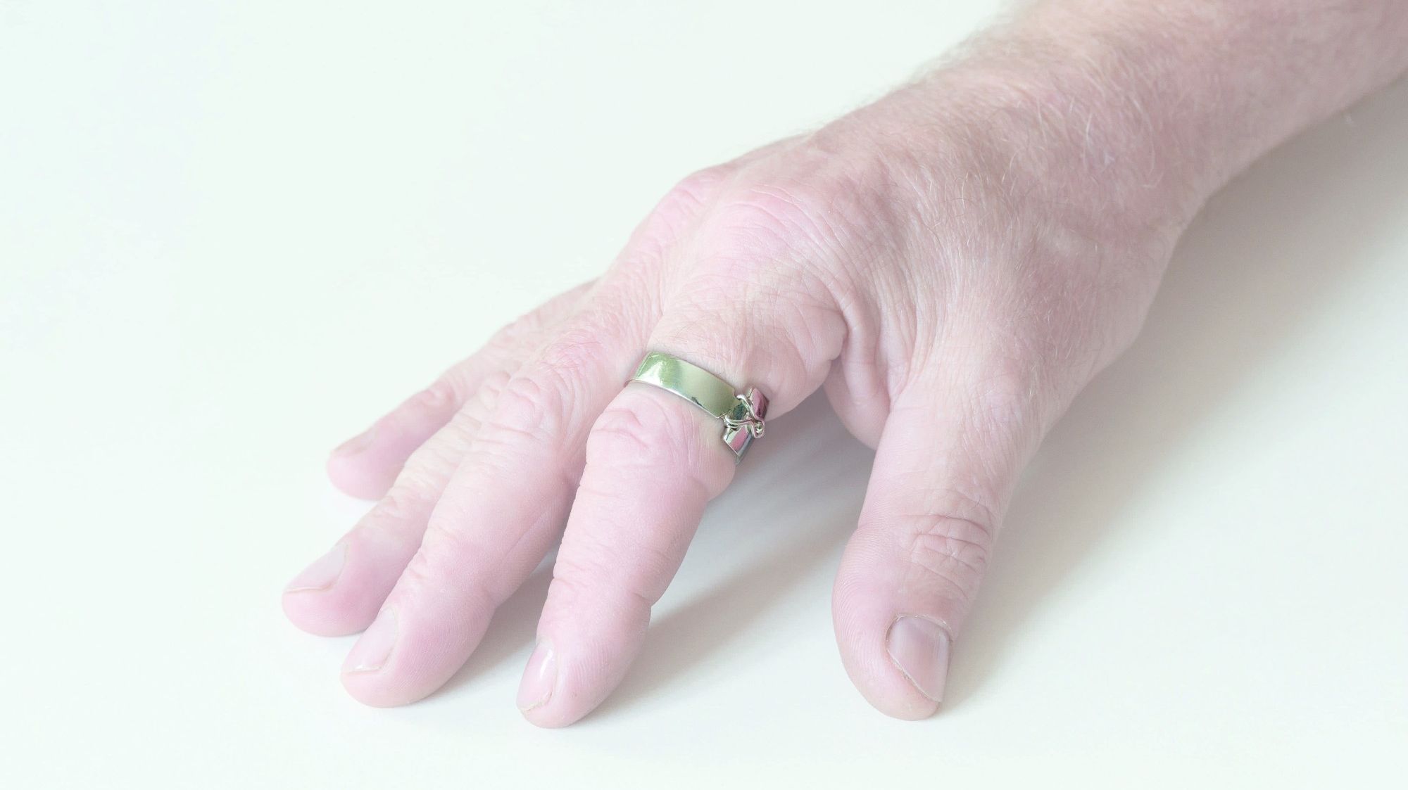 Pulleyring Splint 5020