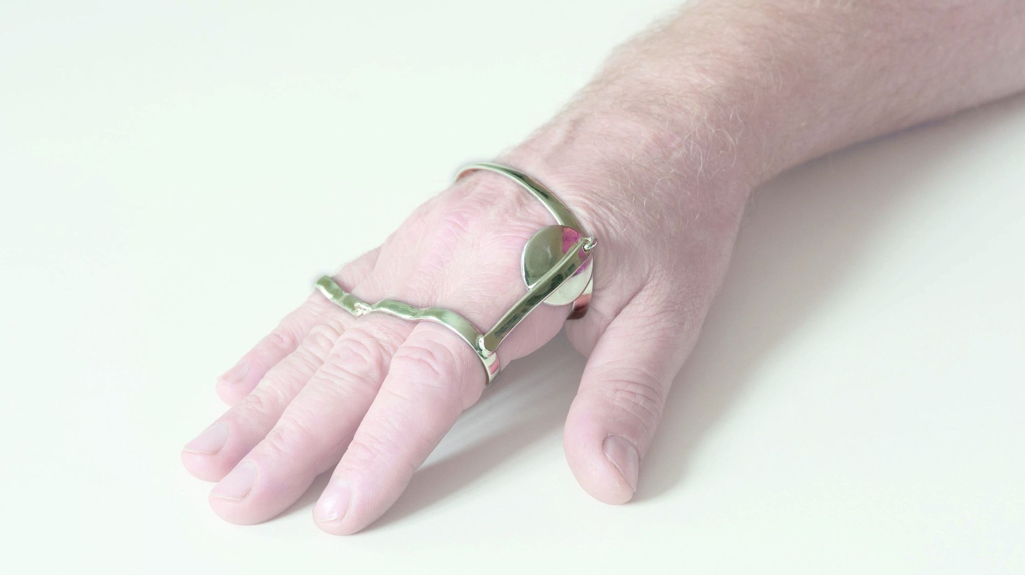 MCP anti-ulnar deviation splint 6023