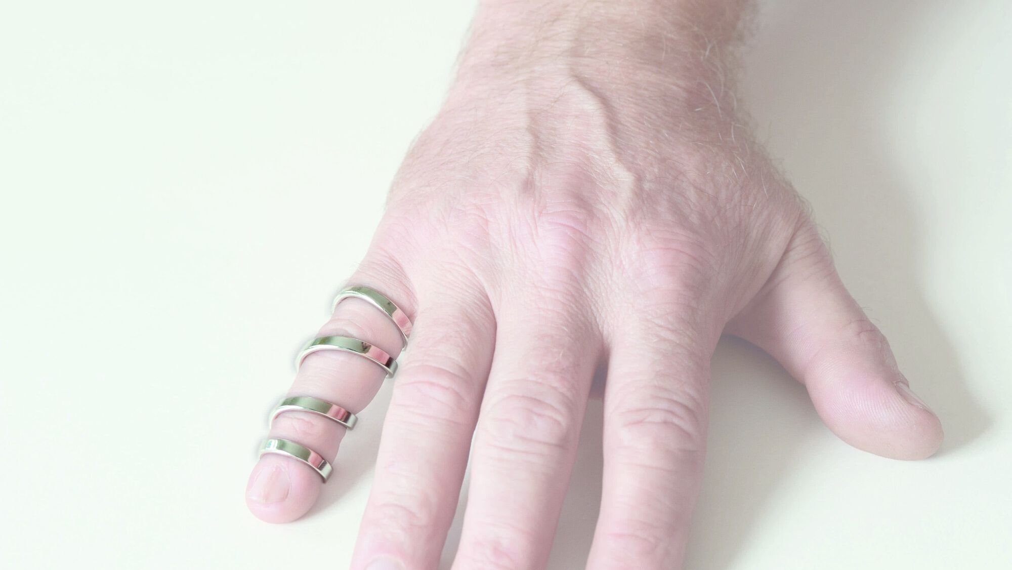 Spiral ring splint (2 joints) 5027