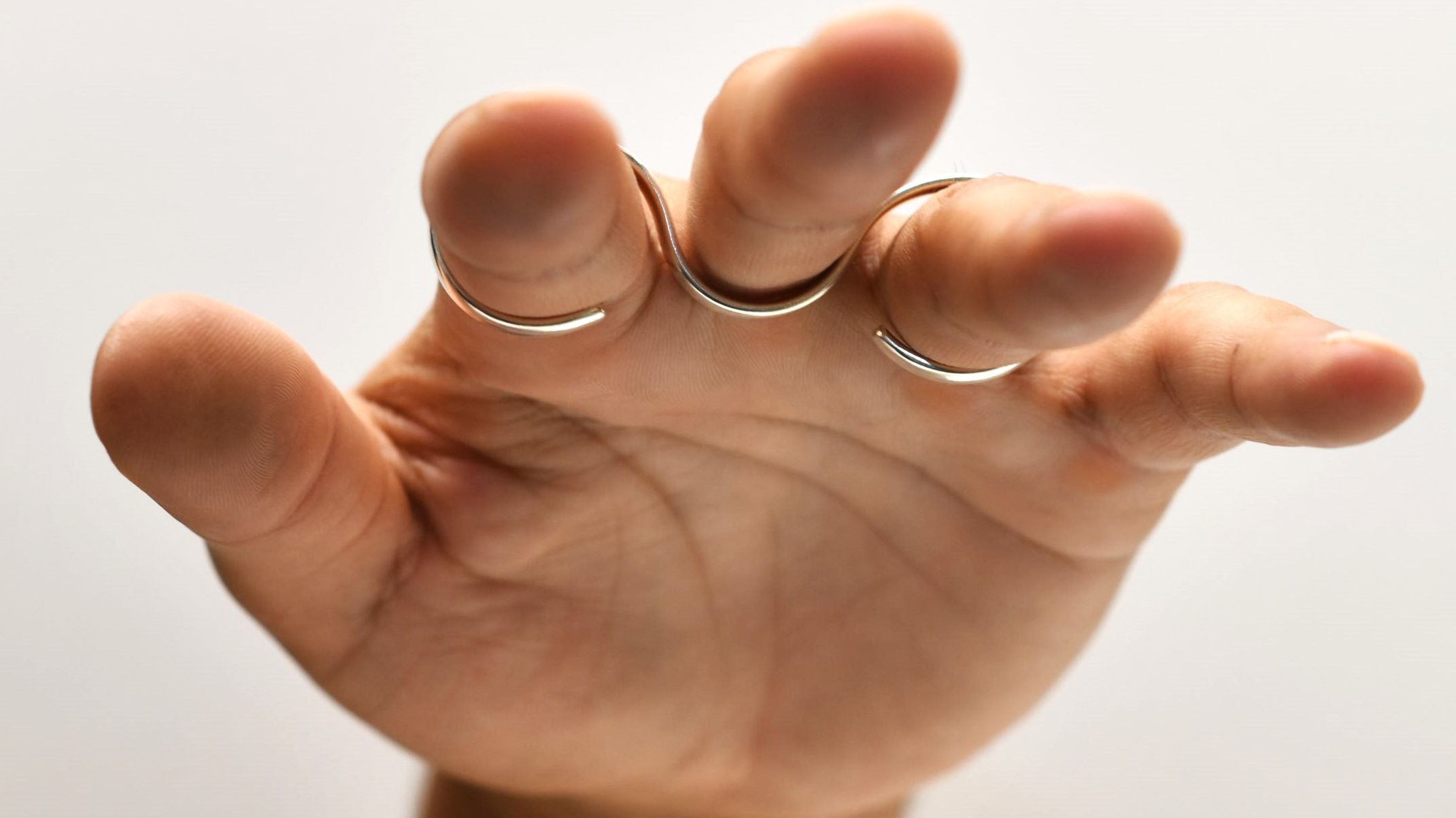 Relative motion splint 5049