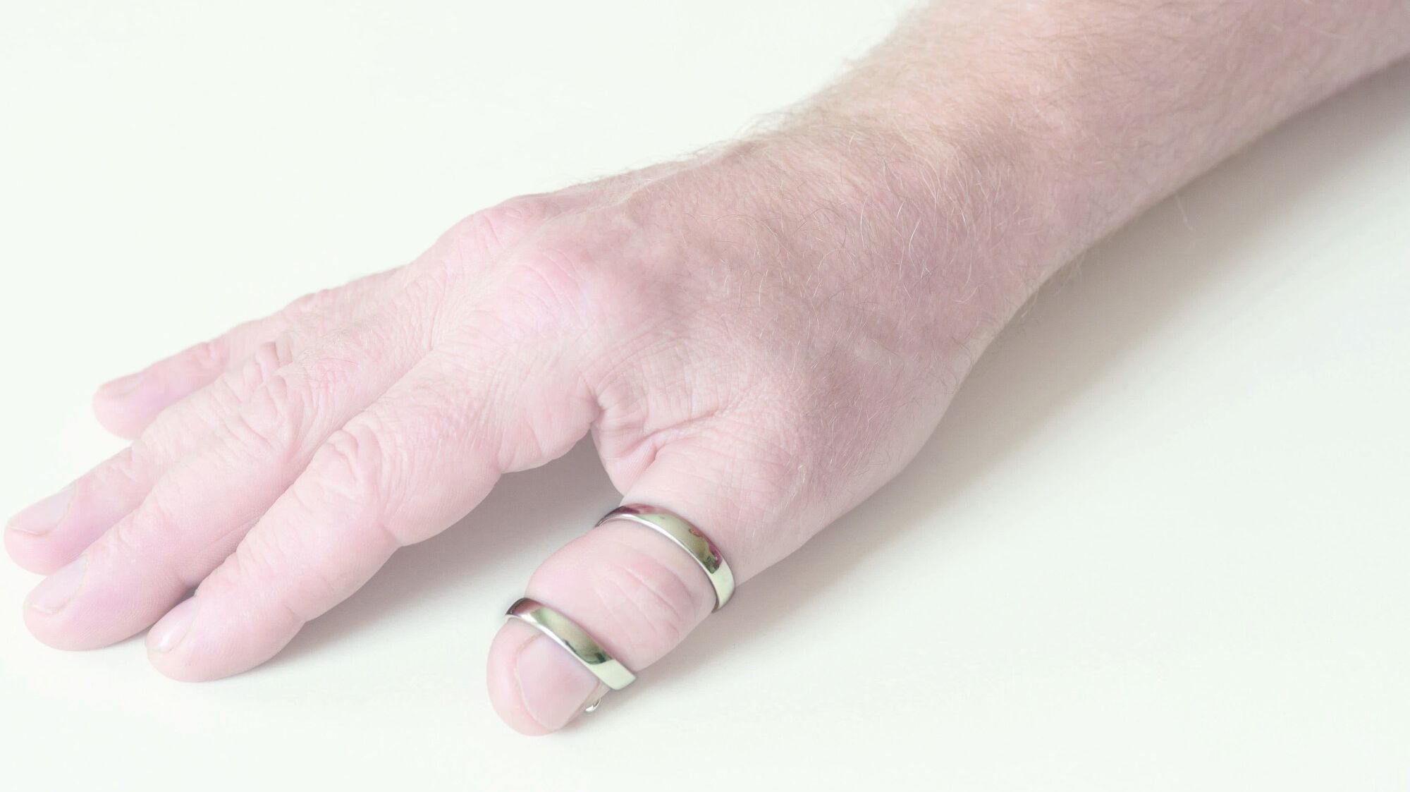 Spiral ring splint (1 joint) 5022