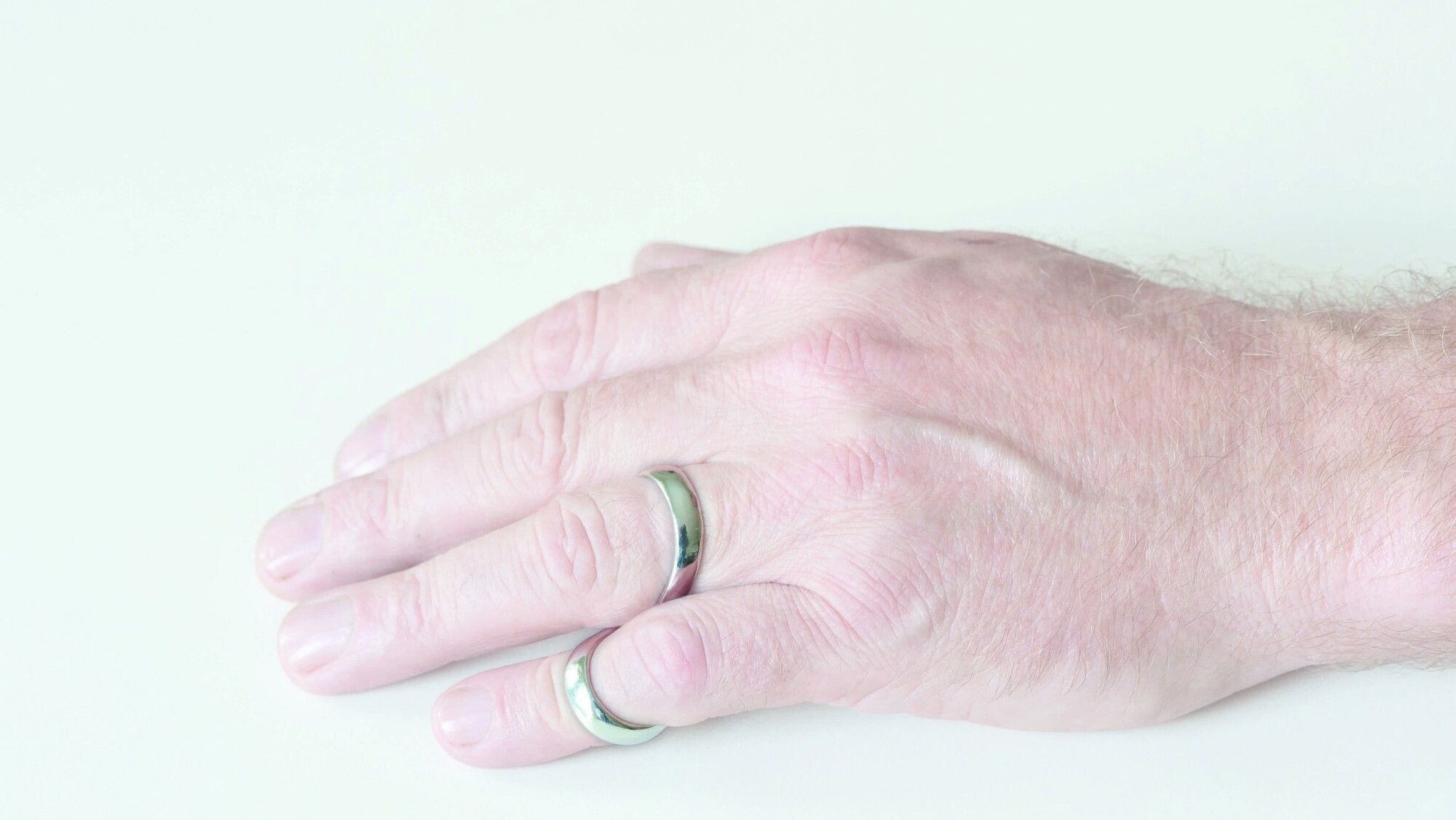 Lemniscate splint 5018