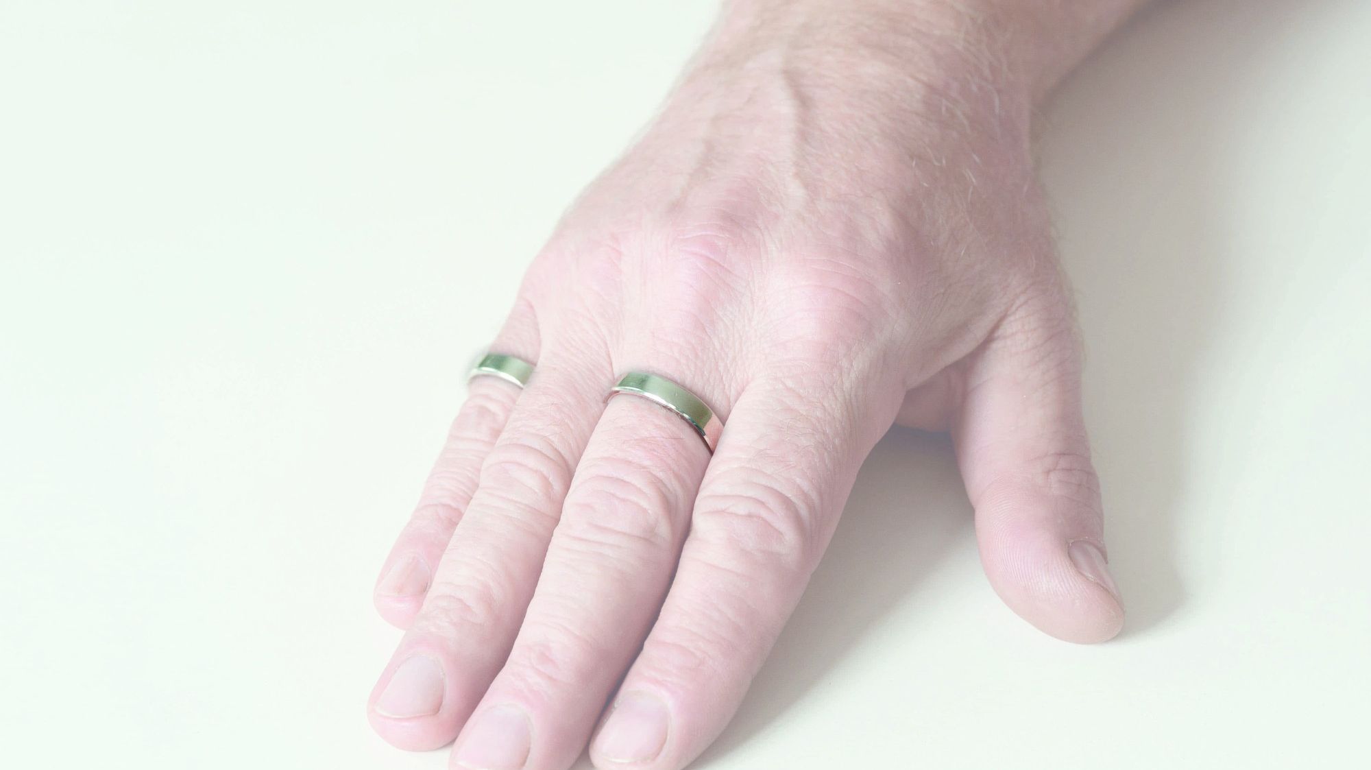 Bridge ring splint 5012 / 5038